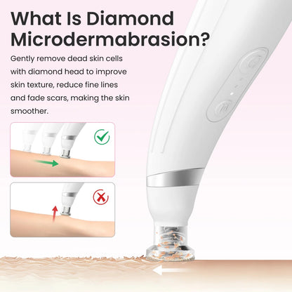 Diamond Microdermabrasion Device